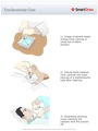 Tracheostomy_Care