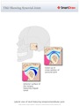 TMJ_Showing_Synovial_Joint