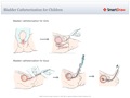 Bladder_Catheterization_for_Children