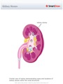 Kidney_Stones