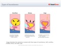 Types_of_Incontinence
