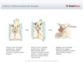 Urinary_Catheterization_for_Female