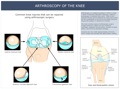 ARTHROSCOPY_OF_THE_KNEE