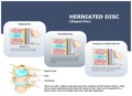 HERNIATED_DISC