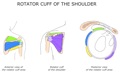 ROTATOR_CUFF_OF_THE_SHOULDER