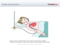 Cardiac_Catheterization