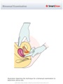 Bimanual_Examination