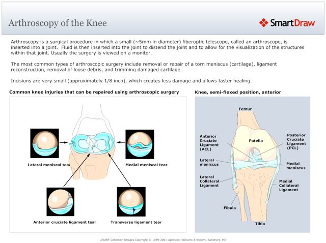 Arthroscopy_of_the_Knee