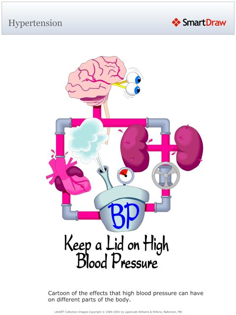 Hypertension