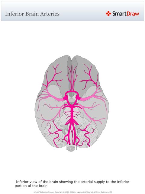 Inferior_Brain_Arteries