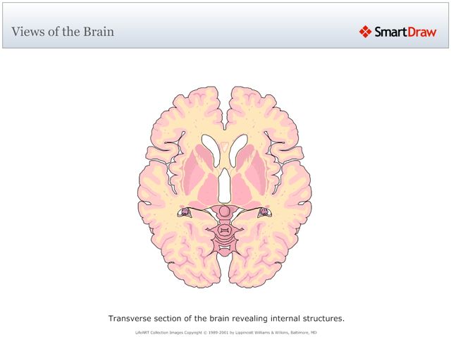 Views_of_the_Brain9