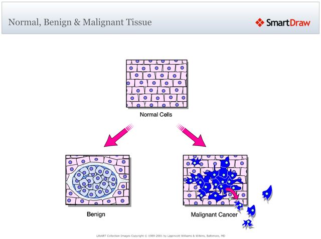 Normal_Benign_&_Malignant_Tissue