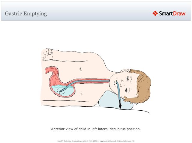 Gastric_Emptying
