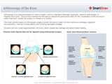Arthroscopy_of_the_Knee