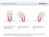 Lateral_Bend_of_the_Neck