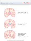 Coronal_Brain_Sections