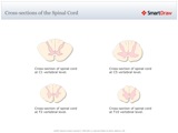 Cross-sections_of_the_Spinal_Cord