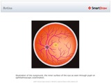 Retina