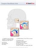 Temporo_Mandibular_Joint