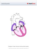 Atrial_Systole