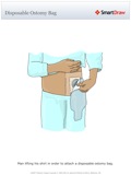 Disposable_Ostomy_Bag